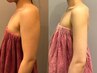 華奢見えボディ☆【上半身徹底◎】二の腕背中デコルテを集中キャビ×リンパ