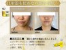 【顔、二の腕】気になる部分の脂肪分解♪レモンボトル＆痩身アロマ40分