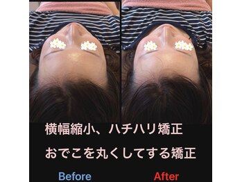 美容矯正サロン レレポノ(LELEPONO)/