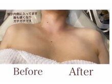 イヴトワエ(eiv Toi et A)/美しい鎖骨ラインがほしい方へ