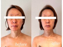 アトリエドゥアージュ(Atelier de age)/エイジングケア正面