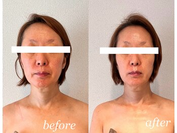 アトリエドゥアージュ(Atelier de age)/エイジングケア正面