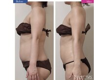 毛穴・脱毛・痩身