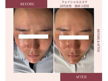 ウェルネス ステーション リンク(Wellness Station Link)/ビフォーアフター