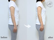 エーアール(AR)/【Before/After】