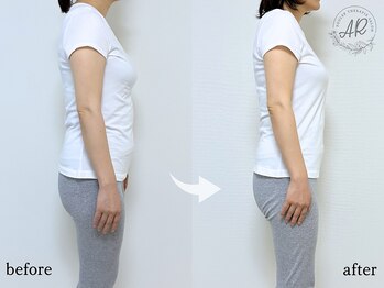 エーアール(AR)/【Before/After】