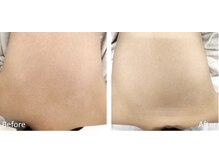 エースビューティー(Ace.Beauty)/