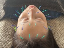 東京鍼灸整骨院