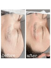 ルルゴ(LULUGO)/メンズハリウッドブロウリフト