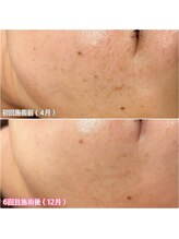 ジン フォー ユアビューティー(JIN for your beauty)/施術経