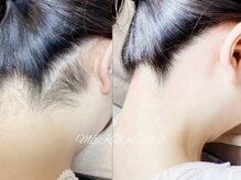 肌が敏感な方、低刺激WAX有り★肌の色で脱毛を断られた方もOK