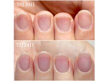アイリー(IRIE)の雰囲気(自爪育成ケアで深爪.噛爪.2枚爪など、お悩み解消!縦長美爪に♪)
