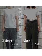 幸葉/整体/骨盤矯正/猫背矯正/小顔