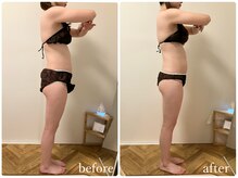 リリィブラン(Lily branc)/ブライダル痩身/背中+二の腕+肩