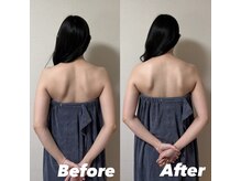 オンユ(Onyu)/ビフォーアフター5