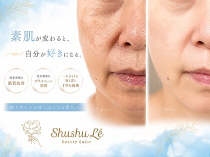 シュシュレ 博多(ShushuLe)の写真