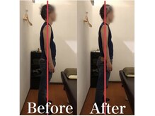 カワル整体 上通り院/【両足が痺れて仕事が辛い】