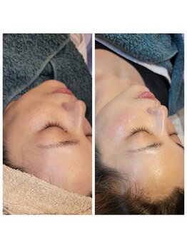 ラデュープラス(Radieux+)/クリスティーナ 《ハーブ》