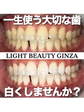 ライトビューティー 銀座店(LightBeauty)/東銀座　ホワイトニング症例写真