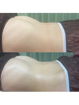 プライベートサロン結/痩身ボディメイク