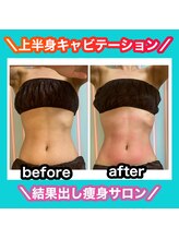 ビューティ ウィッチ(Beauty Witch)/