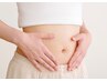 【女性特有のお悩み】全身鍼灸 / 施術時間約50分＋初回カウンセリング30分