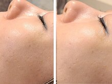 ブラン(BLANC)/サーマルフラクショナル