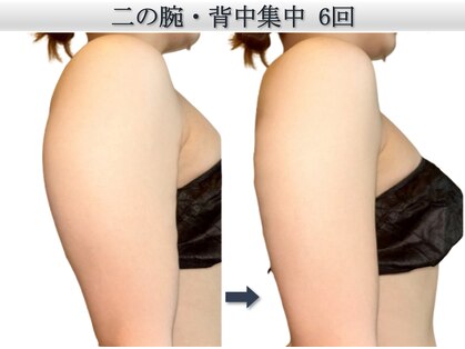 椿(TSUBAKI)の写真
