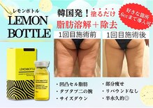 クリニカルエステ イーズ 広島祇園店