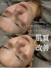 クレビア(CREBIA)/