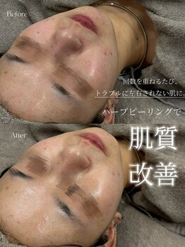 クレビア(CREBIA)/