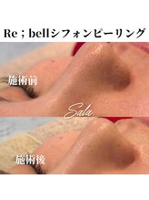 サラ/シフォンピーリング