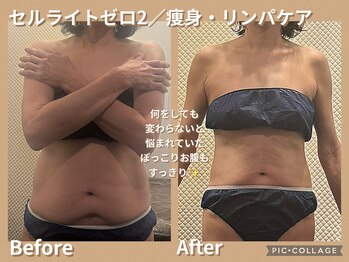 ボディリカバリー(Bodyリカバリー)/ビフォーアフター