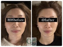 キュープ 富士店(Qpu)