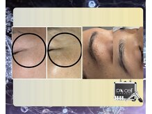 ウィズサロン 天神大名店(withサロン)/プロセル肌診断モニター付き