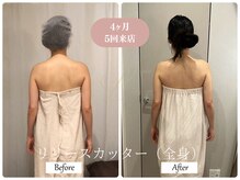 リノ(Lino)/肩こり改善で4ヶ月ご来店♪
