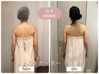 リノ(Lino)/肩こり改善で4ヶ月ご来店♪