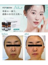 ハート ルポ(Heart)/【フェイシャル】