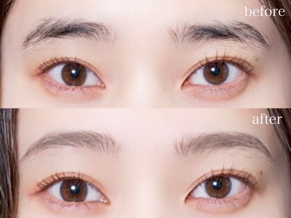 ボンディ(BONDY)の写真