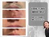 【メンズ脱毛検証】結果重視!ヒゲ脱毛 ★写真撮影、アンケート記入必須★