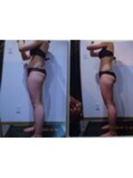 パーフェクトボディプレミアム 渋谷店(PERFECT BODY PREMIUM)/お客様 ビフォーアフター(24)