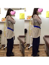 ヒデ整体院(Hide整体院)/肩こり腰痛反り腰改善　骨盤矯正