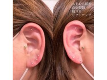 トゥルヌソル 宇都宮(tournesol)/耳ツボジュエリー