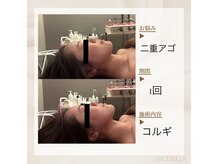 ベレガ 大阪本店(BELEGA)の雰囲気（贅沢トリートメントで1回でも効果を実感）