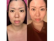 リベルテエイト(Liberte8..)の雰囲気（圧倒的変化、小顔矯正。小顔矯正/造顔/リフトアップ）