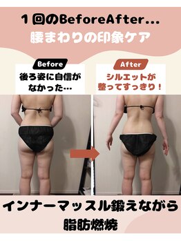 フロレゾン(Floraison)/落ちないヒップ、腰肉落ちます