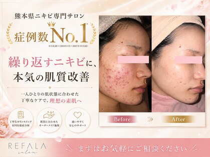 リファラ 光の森店(REFALA)の写真
