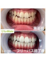 ルブラン 奈良店(Le Blanc)/14日間ご都合の良い日にケア！