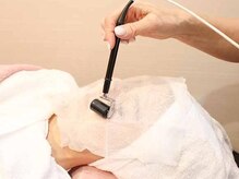 コスメティックス シミズ(SHIMIZU)/イオン導入