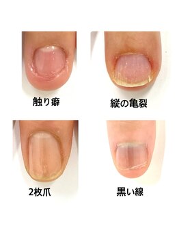 最近ネイルケア